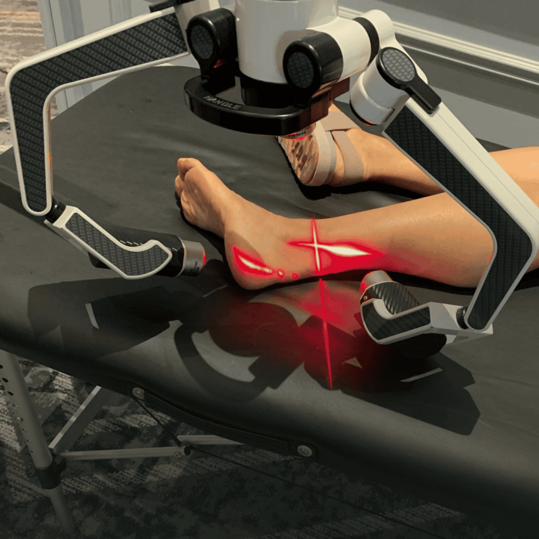Laser Therapy for Foot and Ankle Pain Boca Raton